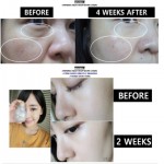 THỰC PHẨM BẢO VỆ SỨC KHỎE INNERB AQUA RICH (AQUA RICH RADIANT SOFT SKIN)