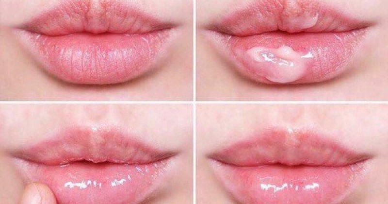 Bỏ Túi Top 6 Sản Phẩm Mặt Nạ Môi Nuôi Dưỡng Môi Căng Mọng